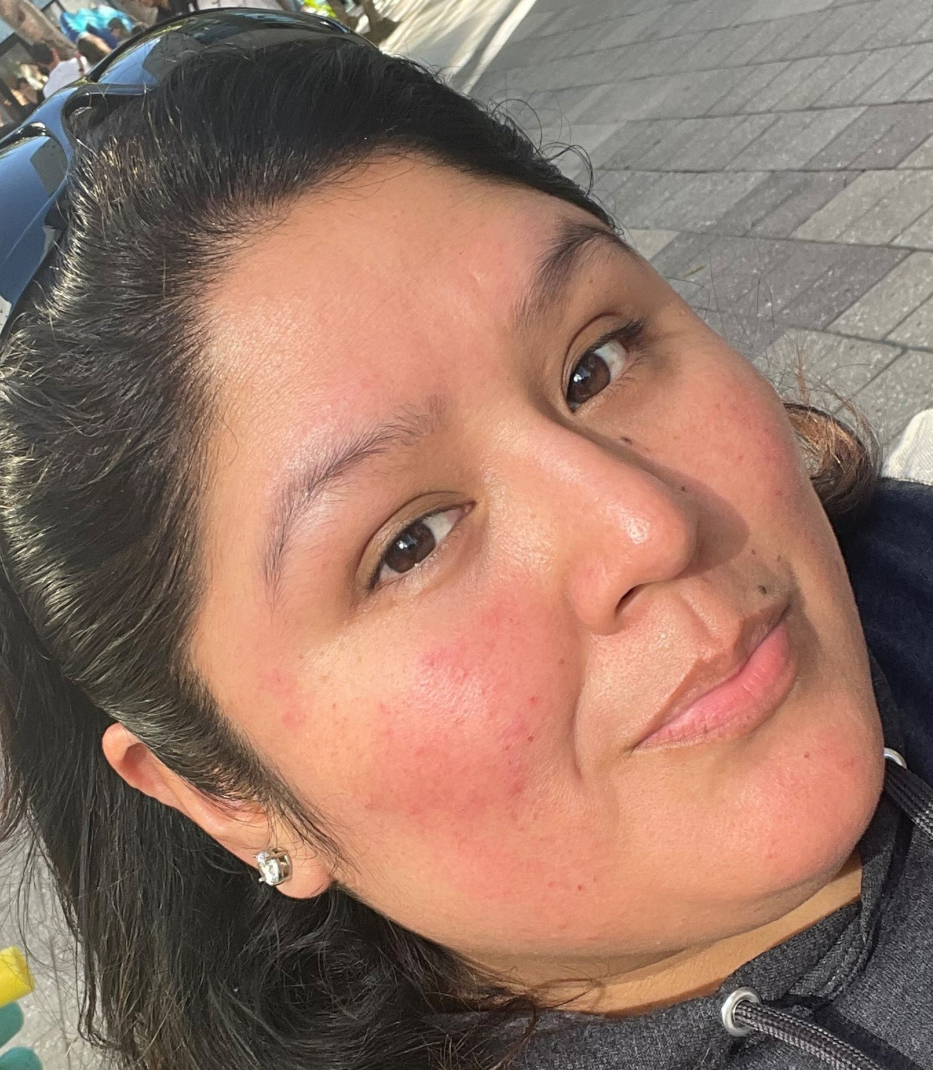 reduce rosacea redness skincare products to help